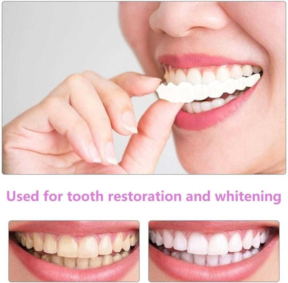 Natural Looking Smile Veneers for Men & Women