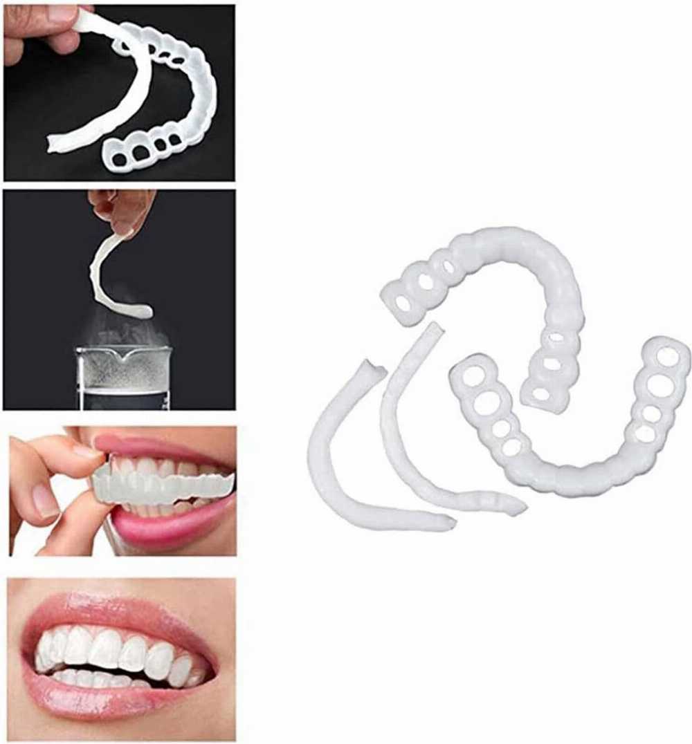 Natural Looking Smile Veneers for Men & Women
