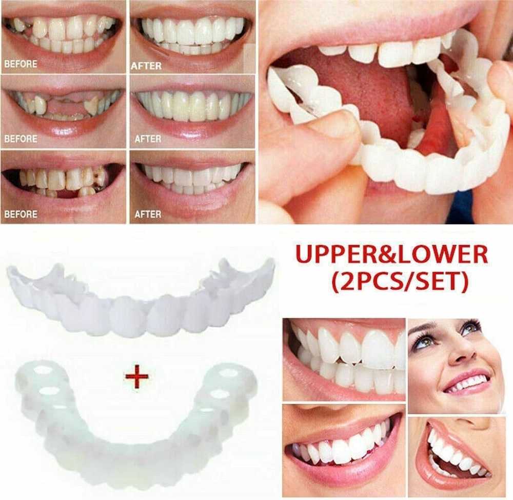 Natural Looking Smile Veneers for Men & Women