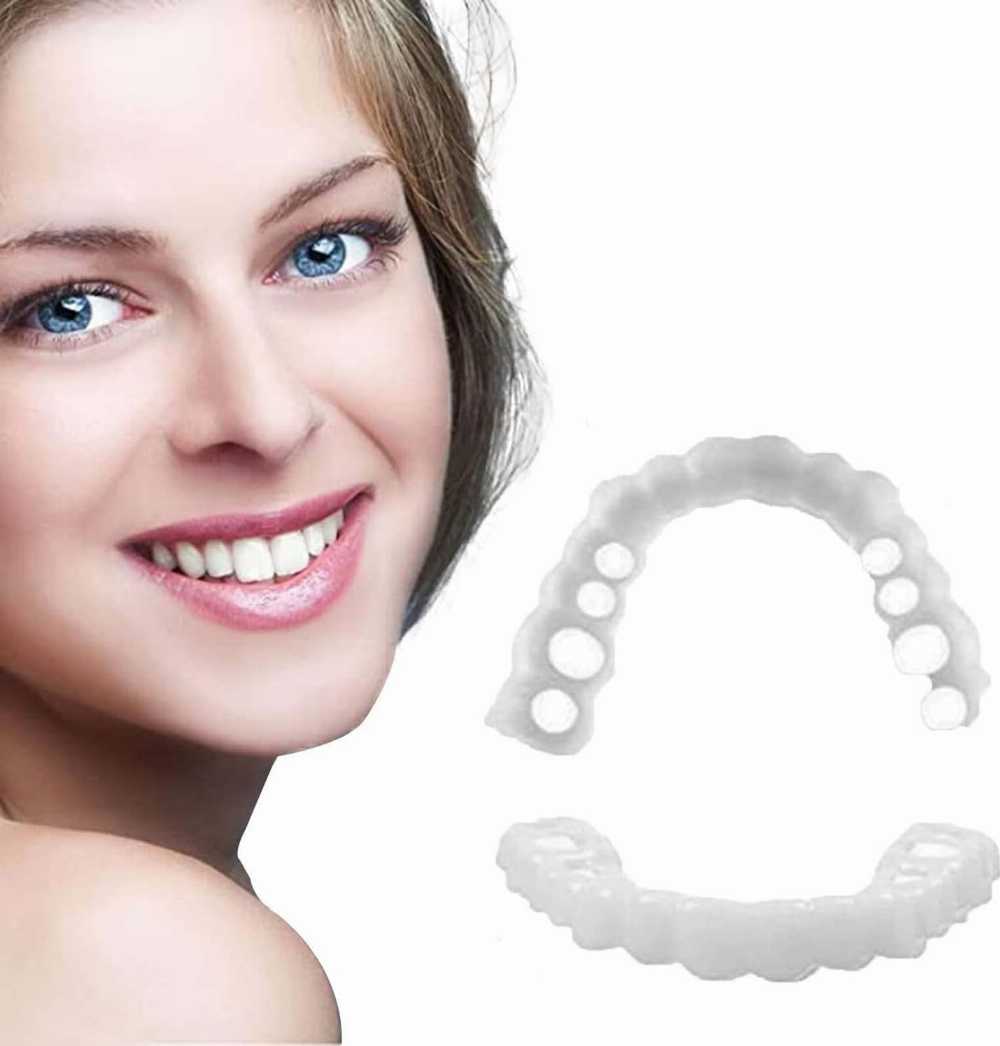 Natural Looking Smile Veneers for Men & Women